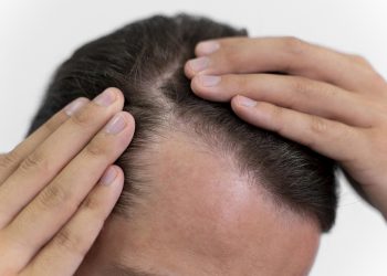 Rambut dan Identitas